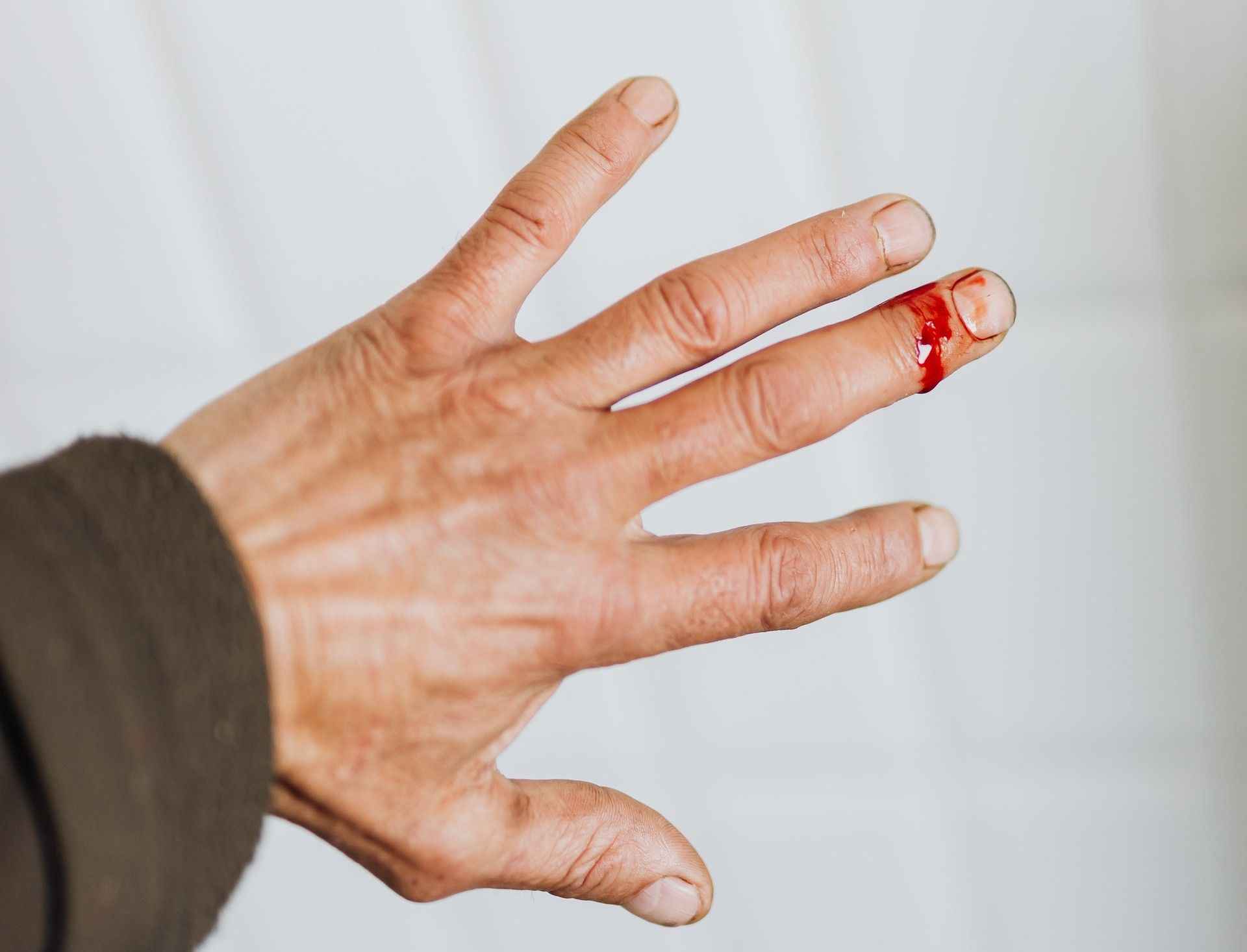 How to Prevent Common Fishing Injuries